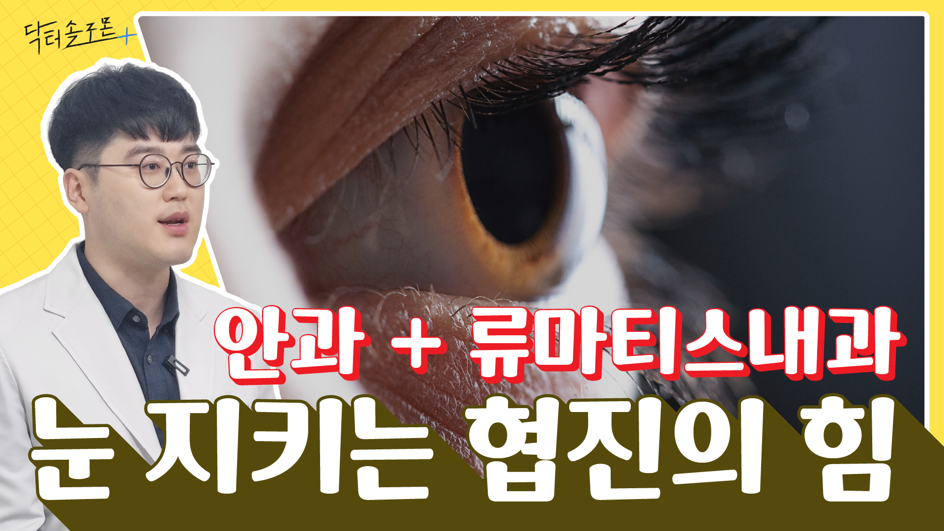 류마티스로부터 눈 지키기: 눈만 치료해선 안 됩니다! 안과 · 류마티스내과 협진이 핵심