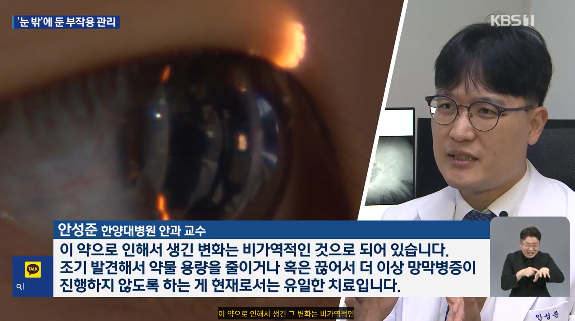 류마티스 약 먹다 시력 손상…정기 검사는 10명 중 1명뿐